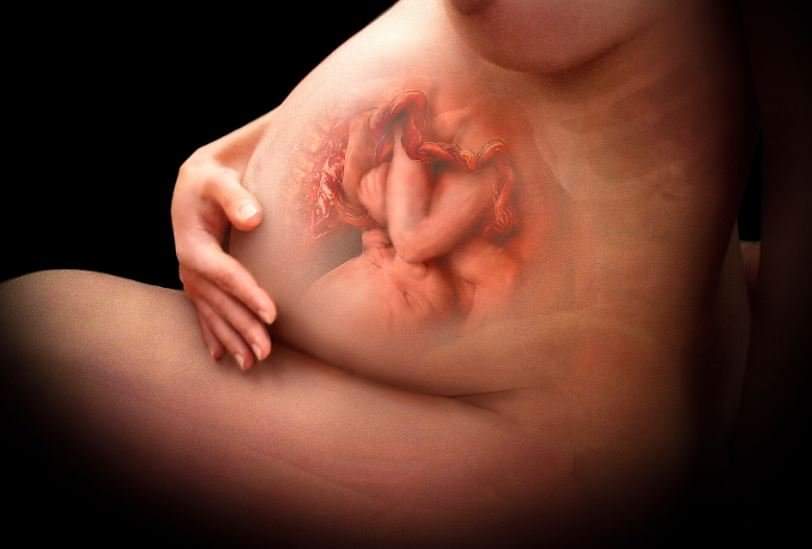 A terhességi kolesztázis