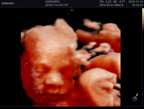Hogyan tudok segíteni, hogy jó legyen a 4D- 5D ultrahang felvétel? (Mikor fogjuk jól látni a kisbabát?)