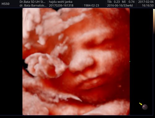 4D – 5D ultrahang (szakorvosi vizsgálat-,babamozi-) tájékoztató